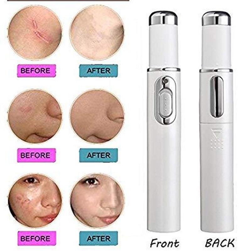 1pcs Medical Blue Light Therapy Laser Treatment Pen Soft Scar Wrinkle Removal Treatment Device 